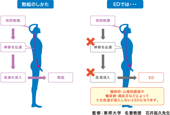 EDのメカニズム図解 - 陰茎海綿体への血流とED発症の関係